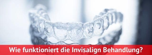 invisalign behandlung